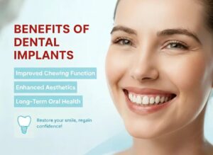 Benefits of Dental Implants