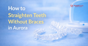 Straighten Teeth Without Braces
