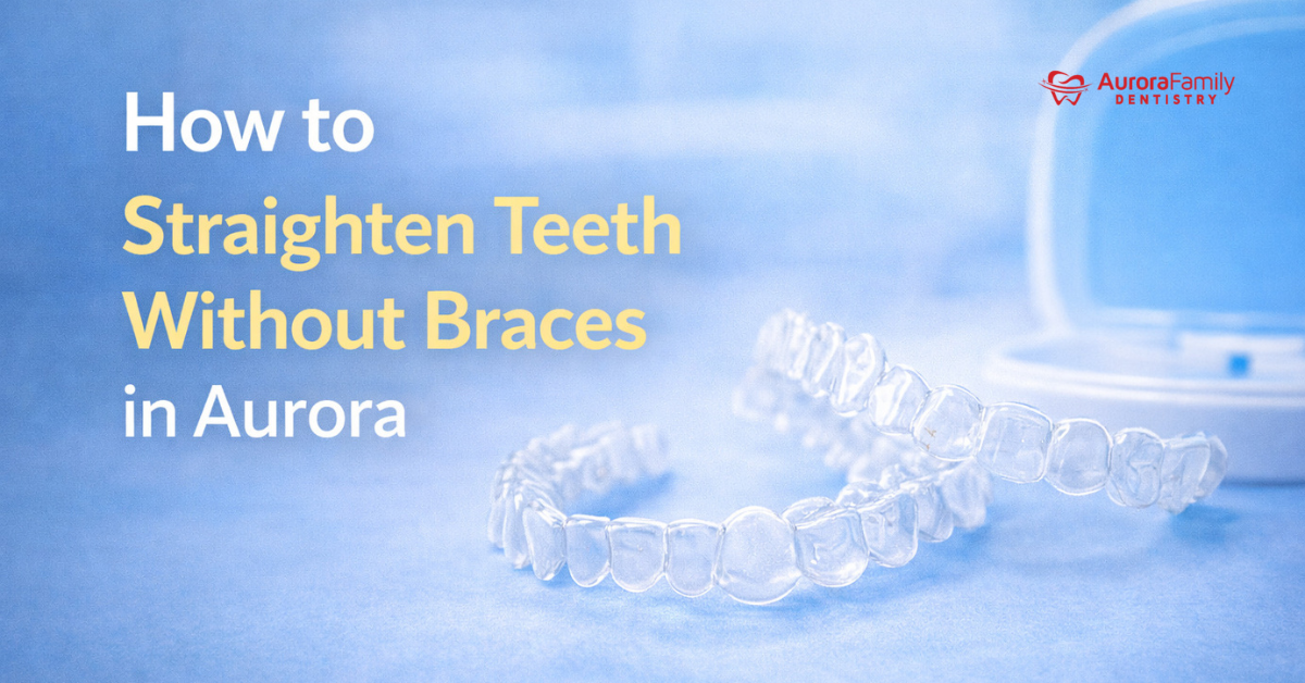 Straighten Teeth Without Braces