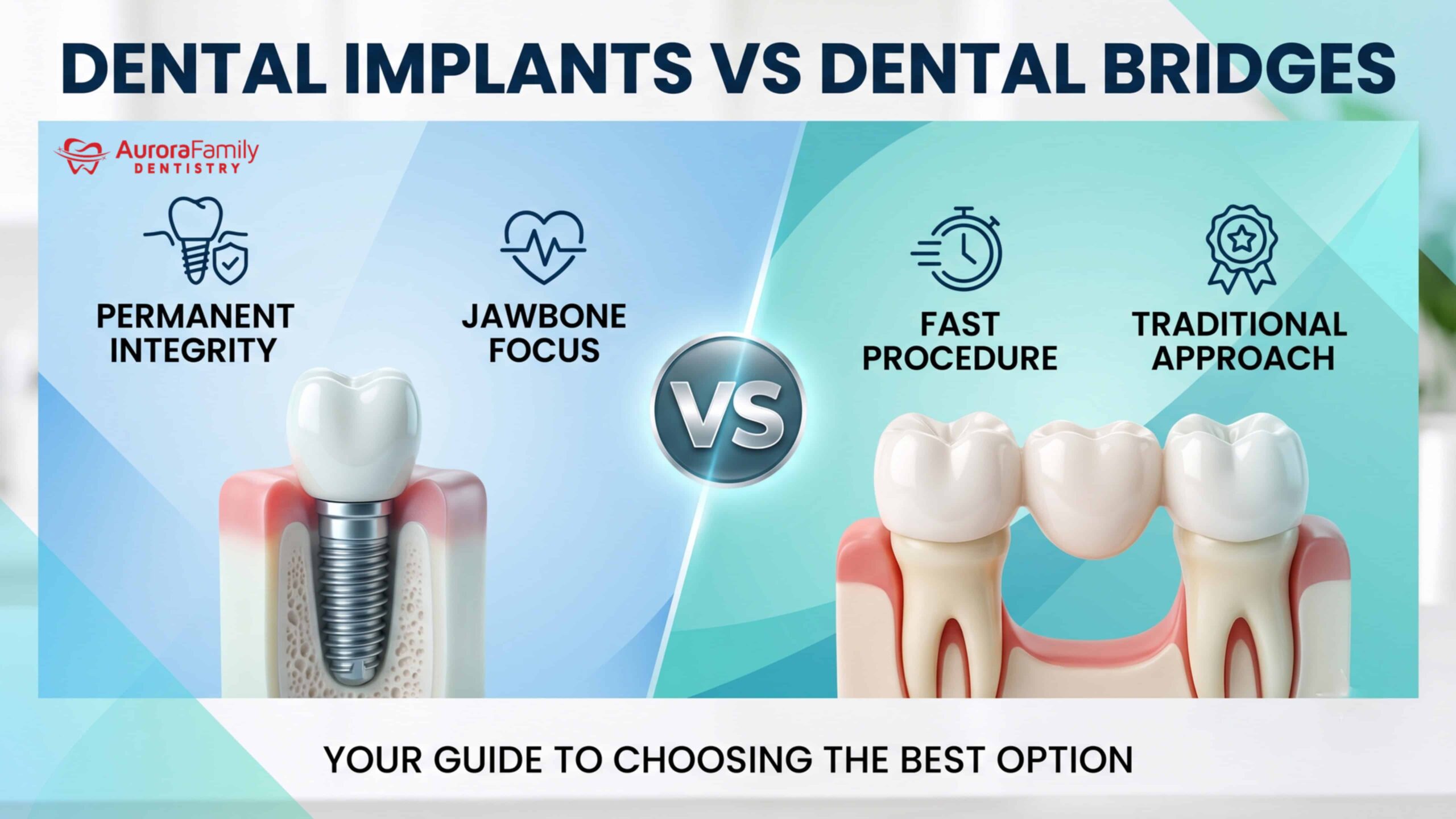Dental Implants vs Dental Bridges