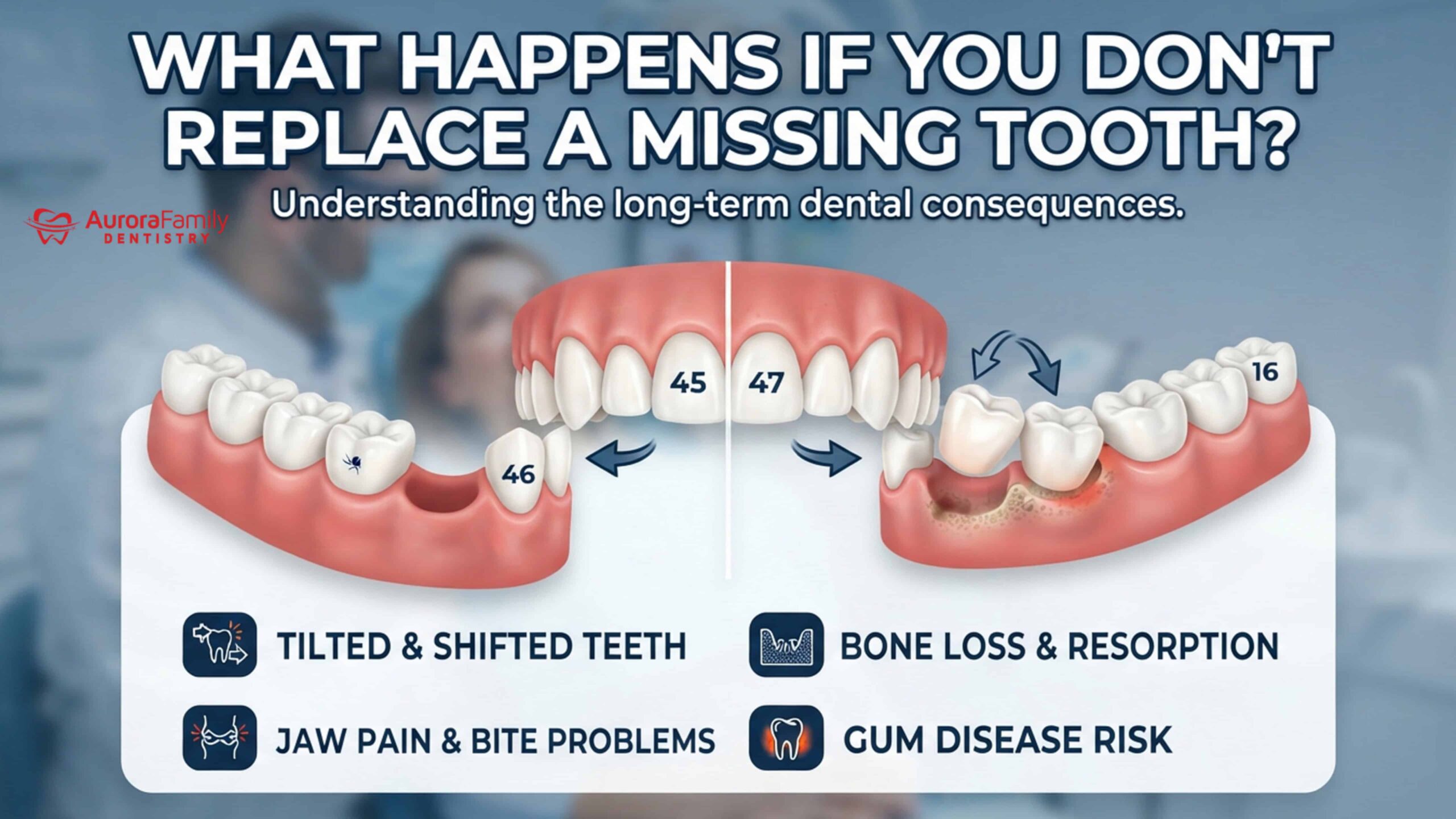What Happens If You Don’t Replace a Missing Tooth